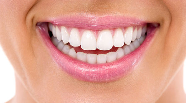 2-teeth-whitening-after-1